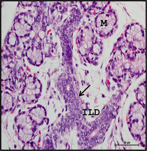 Figure 11. Photomicrograph of 40.5 cm CVRL (165th day) buffalo foetus showing stratified cuboidal epithelium (arrow) of intralobular ducts (ILD) of mandibular gland. (M-mucous cell). Haematoxylin and Eosin method ×400.