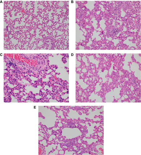 Figure 1 Images showing thickness of the alveolar wall. (A) Group C, mild alveolar damage in Group C, HE x100. (B) Group PC, severe alveolar damage in Group PC, HEX200. (C) Group PC-D, moderate alveolar damage in Group PC-D, HEX400. (D) Group PC-K, severe-moderate alveolar damage in Group PC-K, HEX200. (E) Group PC-D+K, moderate alveolar damage in Group PC-D, +K, HEx200.