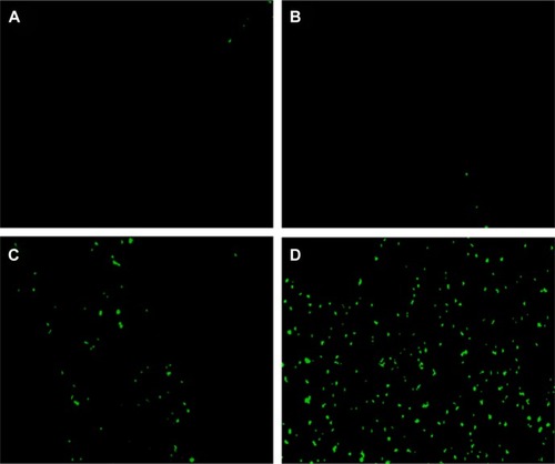 Figure 10 TUNEL test.Notes: The TUNEL assay was performed for the detection of tumor cell apoptosis in glioma model. Tumor sections of each group treated with NS (A), empty micelles (B), free curcumin (C), and Cur/MPEG-PLA micelles (D) were stained with TUNEL for observation of cell apoptosis. Compared with free curcumin, Cur/MPEG-PLA micelles showed a prominent apoptosis induction effect.Abbreviations: TUNEL, terminal deoxynucleotidyl transferase-mediated dUTP nick-end labeling; NS, normal saline; Cur, curcumin; MPEG-PLA, monomethoxy poly(ethylene glycol)-poly(lactide) copolymer.