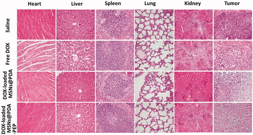 Figure 9. H&E analyses of tumors and major organs of nude mice bearing HT-1376 cell xenograft after treatments with saline, free DOX, DOX-loaded MSNs@PDA and DOX-loaded MSNs@PDA-PEP.