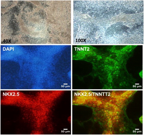 Figure 2. Characterization of iPS-derived cardiomyocytes.