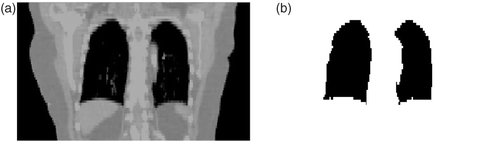 Figure 4. (a) Coronal view in an original CT image. (b) The segmented lungs in this CT image.