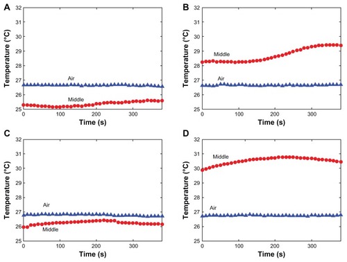 Figure 7 Plots of temperature increase for the egg white (A), the egg white with magnesium nanoparticles at 0.02 g/mL (B), egg yolk (C), and egg yolk with magnesium nanoparticles at 0.02 g/mL (D) in 10 mL beakers, as a function of irradiation time, under irradiation by diode laser at power of 1.5 W.