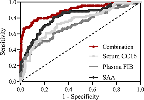 Figure 3 ROC analysis of predictive values of serum CC16, plasma FIB, SAA at admission and their combination test for the prognosis assessment of AECOPD in one year follow-up.