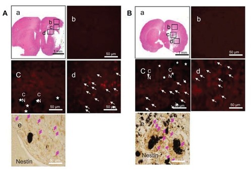 Figure 4 (A) Hydrophilic and (B) hydrophobic carbon nanotubes were impregnated with bromodeoxyuridine-stained (red; original magnification ×400) subventricular zone neural progenitor cells and transplanted onto the injury site after middle cerebral artery occlusion injury. The images show (a) the cross section of the injured brain stained with hematoxylin and eosin (where b□, c□, and d□ represent the cortex, corpus callosum, and striatum region of the brain, respectively), the migration of carbon nanotubes in the (b) cortex region, (c) corpus callosum, and (d) striatum region of the brain, and (e) diaminobenzidine staining results for nestin immunoreactivity (evidenced by brownstained cells) 1 week after transplantation.Notes: Carbon nanotubes appear black in the histological sections and are marked by □. Arrows indicate bromodeoxyuridine-labeled subventricular zone neural progenitor cells. Original magnification for immunohistological staining was ×800. Scale bars =50 μm.Abbreviation: CN, carbon nanotubes.
