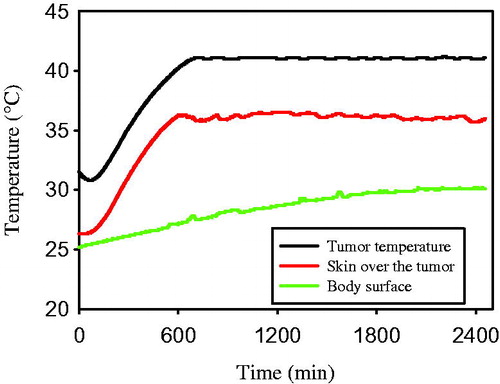 Figure 1. Temperature profile during heating of FSaII tumours with Oncothermia. T1: Intratumour temperature determined with a thermal probe inserted into the middle of tumour, T2: temperature of the skin surface over subcutaneous tumours determined by placing a thermal probe between the tumour and upper heating electrode, T3: temperature of the skin surface determined by placing a thermal probe between the mouse and lower electrical plate on which the mouse was placed.