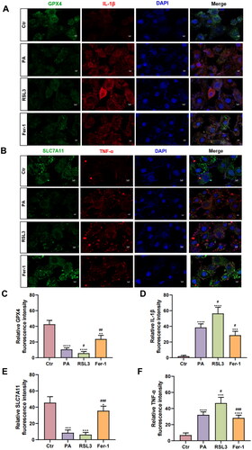 Figure 5. The immunofluorescence staining results of ferroptosis key factor and inflammatory factors. (A) The immunofluorescence staining results of GPX4 (green) and IL-1β (red). Blue stands for DAPI. Scale bar = 5 μm. (B) The immunofluorescence staining results of SLC7A11 (green) and TNF-α (red). Blue stands for DAPI. Scale bar = 5 μm. (C–F) Summarized data of immunofluorescence staining of GPX4 (C), IL-1β (D), SLC7A11 (E), and TNF-α (F) in the four groups. The values are presented as means ± SD. n = 6 in each group. * p < .05, ** p < .01, *** p < .001, **** p < .0001, when compared to the Ctr group; # p < .05, ## p < .01, ### p < .001, when compared to the PA group.