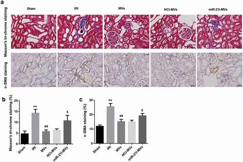 Figure 7. Effects of MSC-MVs administration on the renal fibrosis. (a) Representative images of Masson’s trichrome staining and α-SMA immunostaining in the injured kidneys at 2 week after reperfusion treated with MSC-MVs (Scale bar = 25 μm). (b) Quantification of percentage of Masson staining positive area in the kidney sections after reperfusion with MSC-MVs. (c) Quantification of α-SMA-positive cells in the kidney sections after reperfusion with MSC-MVs. N = 8 in each group.