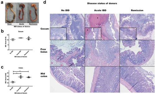 Figure 2. Microbiomes of mice with acute IBD or in remission from IBD induce more severe IBD in GF Smad3+/- mice compared to microbiomes of healthy mice. GF Smad3+/- mice were colonized with microbiomes of mice with acute IBD, in remission, and without IBD for 6 days. IBD was scored in the colon and cecum of individual mice by histological analysis. (a) Representative pictures of the cecum and colon of recipient mice that were colonized with microbiomes of mice without disease, with acute IBD or in remission. IBD scores of (b) cecum and (c) colon are shown. Possible score ranges for each tissue type are indicated on the Y-axis labels. (d) Representative histological images are shown of the cecum, proximal colon and mid colon for each colonization group. All mice have severe inflammation with regionally extensive severe mucosal ulceration in the cecum, although the mice colonized with acute IBD microbiomes have marked necrotic material expanding the lumen of the cecum (asterisk). In the proximal and mid colon, mice colonized with healthy microbiomes (no IBD) have minimal inflammation, whereas mice colonized with acute and remission IBD microbiomes have moderate diffuse inflammation. Horizontal bars represent mean ± SEM. One-way ANOVA test was performed followed by a post-hoc test of pair-wise comparisons with Bonferroni’s multiple comparison adjustment. **, p < 0.01.