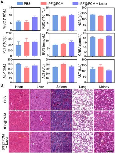 Figure 7 In vivo toxicity evaluations of tPF@PCM. (A) Hematological and biochemistry analyses of peripheral blood from different groups of mice at day 15 (n = 3). The results show the mean and standard error of the mean (SEM) of white blood cells (WBC), red blood cells (RBC), hemoglobin (HGB), platelets (PLT), blood urea nitrogen (BUN), creatinine (CREA), alkaline phosphatase (ALP), alanine aminotransferase (ALT), and aspartate aminotransferase (AST). All values were within normal limits. (B) H&E staining of major organs dissected from treated mice at day 15 (n = 3). Scale bar represents 200 μm.