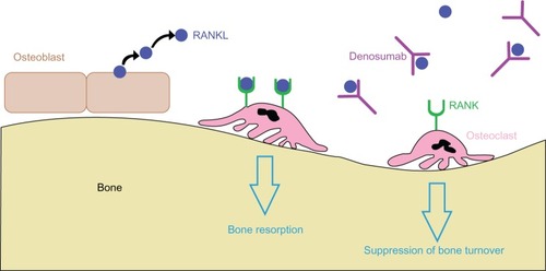 Figure 1 Mechanism of action of denosumab. High affinity binding of denosumab to RANKL inhibits osteoclast maturation, activity, and survival by preventing RANKL from binding the RANK receptor on immature and mature osteoclasts. This decreases bone resorption and suppresses bone turnover.
