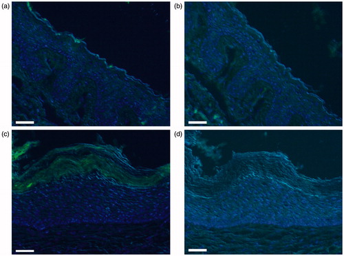 Figure 4. Photomicrographs of fluorescence immunohistochemical staining for TRPV6. The panels show positive staining/negative control pairs of the postauricular skin (a/b) and cholesteatoma tissue (c/d). Green and blue colors express the fluorescence of Alexa Flour 488 and DAPI, respectively. No fluorescence is observed in the skin, and the cholesteatoma tissue exhibits weak fluorescence only in the horny layer. Scale bar = 50 μm.