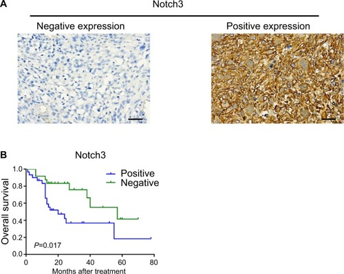Figure 1 (A) Tumor cells were negative for Notch3 in case 12 (left); tumor cells were positive for Notch3 in case 44 (right) (EnVision ×400, scale 50 µm); (B) Kaplan–Meier survival curves and log-rank test for cumulative survival of the Notch3+ group and Notch3− group; P=0.017.