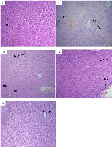 Figure 4 Histopathological section of liver tissues in control and experimental groups of mice in the post-treatment model; showing normal hepatic cells (H), lymphocytic inﬁltrates (L), mild lymphocytic inﬁltrates (ML), mild necrosis (NL), and extensive necrosis (EN). (A) Normal control received with distilled water, (B) toxic control received CCl4, (C) treated with 500 mg/kg extract, (D) treated with 500 mg/kg butanol fraction, and (E) treated with silymarin 100 mg/kg.