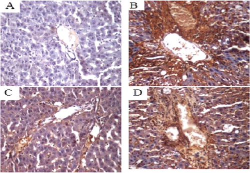 Figure 6. COX-2 protein expression in liver tissue of SD rats (immunohistochemistry, 400×). Normal control group (A); model group (B); COX-2 shRNA-1 group (C); empty vector group (D).
