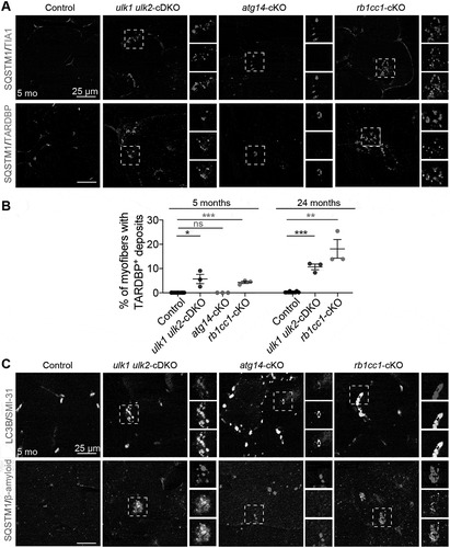 Figure 3. Deficiency of Rb1cc1 and Ulk1 Ulk2 but not Atg14 in the skeletal muscle causes TARDBP+ pathology. (A) Frozen sections of quadriceps from control, ulk1 ulk2-cDKO, atg14-cKO, and rb1cc1-cKO mice at 5 months were co-stained with antibodies against SQSTM1 and TIA1 or SQSTM1 and TARDBP. (B) Percentages of myofibers in quadriceps with TARDBP+ deposits quantified from 5-month-old and 24-month-old controls, ulk1 ulk2-cDKO, atg14-KO, and rb1cc1-cKO mice. n = 3 for each genotype; ns: not significant. *P < 0.05, **P < 0.01, ***P < 0.001 by student’s t-test. (C) Frozen sections of quadriceps from 5-month-old control, ulk1 ulk2-cDKO, atg14-cKO, and rb1cc1-cKO mice co-stained for LC3B and phosphorylated MAPT/Tau (SMI-31) or SQSTM1 and β-amyloid (peptide 1–42)