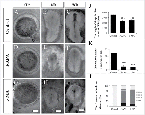 Figure 3. The Disturbance of autophagy retards chick embryo development. The evaluation of chick embryo development was fulfilled following the treatment of either RAPA or 3-MA compared to control. A-I: The bright-field images of the developing embryos in control group (A-C), RAPA treated group (D-E) or 3-MA treated group (F-I) at 0 hour, 18 hour and 33 hour respectively. J: Bar chart showing the comparison of the length of primary streak in embryos at stage HH4 between the control, RAPA treated and 3-MA treated group. K: Bar chart showing the number of embryos in different stages at 33-hour incubation between the control group, RAPA treatment group and 3-MA treated group. L: Bar charts showing the pairs of somites at 33-hour incubation between the control group, 3-MA treated group and RAPA treated group. ***P < 0.001 indicating highly significant difference between RAPA-or 3-MA-treated and control embryos. Scale bars = 1000 μm in A,D,G, 700 μm in B,E,H, and 600 μm in C,F,I.