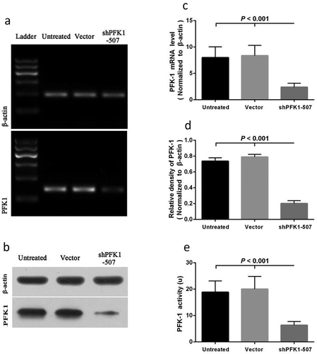 Figure 3. Effects on shRNA-mediated silencing of PFK1 at the mRNA and protein levels. The CNE2 cells were stably transduced with a sh-PFK1-507 plasmid or a control vector. The expression of PFK1 mRNA (a) and protein (b) in stable clones was examined by RT-PCR and Western blot analysis. β-actin served as an internal control. mRNA or Protein quantification was obtained by densitometric analysis of the mRNA (c) or protein (d). (e) Effects of PFK1 knockdown by sh-PFK1-507 on enzyme activity. All experiments were performed at least three times with consistent and repeatable results