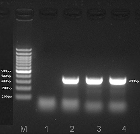 Figure 3 A 399-bp target fragment mapping to M. hominis, identified by sequence-specific PCR. Lane M: DNA ladder; Lane 1: negative control; Lane 2: annealing temperature of 58 °C; Lanes 3 and 4: annealing temperature of 60 °C.