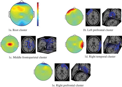 Figure 1. Scalp maps and 3D dipole plots for the country music stimulation task(a) Root cluster, (b) Left prefrontal cluster, (c) Middle frontoparietal cluster, (d) Right temporal cluster, (e) Right prefrontal cluster