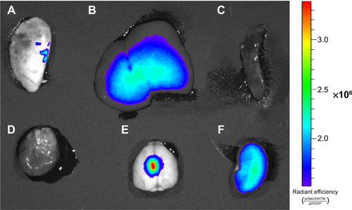 Figure S2 Optical images of rat organs.Notes: (A) Lung; (B) liver; (C) spleen; (D) heart; (E) brain; (F) kidney.