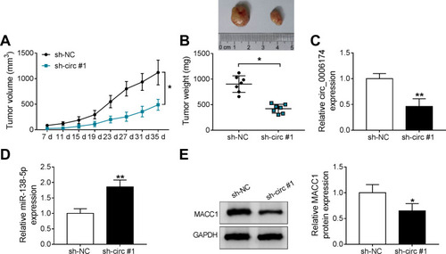 Figure 7 Knockdown of circ_0006174 inhibited tumor growth in vivo. (A) After nude mice were injected with SW620 cells transfected with sh-circ #1 or sh-NC for 7 days, tumor volumes were recorded every 4 days for 35 days. (B) Tumor weight was measured after the nude mice was euthanized. (C and D) The expression of circ_0006174 and miR-138-5p in transplanted tumor tissues with circ_0006174 knockdown. (E) Relative MACC1 protein level in nude mice that injected with SW620 cells stable transfected with sh-circ #1 or sh-NC. Three independent assays were performed, and data were presented as means ± SD. *P<0.05, **P<0.01.