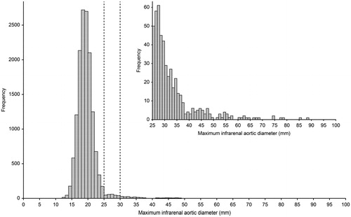 Figure 2. Infrarenal aortic diameters. Histogram presenting the distribution of the maximum infrarenal aortic diameter for the screened cohort of 65-year-old men. Embedded is a selective histogram of the size distribution of infrarenal aortic diameters ≥25 mm.