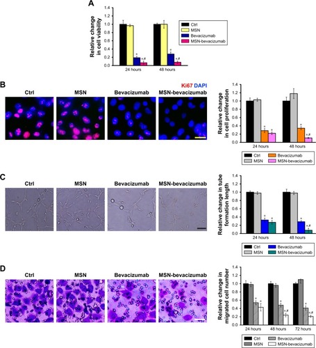 Figure 4 MSN-encapsulated bevacizumab nanoparticles inhibit VEGF-mediated endothelial angiogenic functions in vitro.Notes: (A) HUVECs were cultured in the serum-starved condition for 1 hour and treated with VEGF (10 ng/mL) for the indicated times. They were also incubated with MSN-PEG-NH2, bevacizumab (1 µg/mL), or MSN-encapsulated bevacizumab nanoparticles (1 µg/mL). Cell viability was detected by MTT assays (n=4). (B) Cell proliferation was detected by Ki67 staining (n=4). A representative image along with the quantitative result is shown. Scale bar, 20 µm. (C) HUVECs were seeded on the Matrigel matrix. The tube-like structures were observed after 24 or 48 hours of cell culture. A representative image along with the quantitative result is shown (n=4). Scale bar, 50 µm. (D) Transwell assays were conducted to detect HUVEC migration (n=4). A representative image along with the quantitative result is shown. Scale bar, 100 µm. *P<0.05; #P<0.05.Abbreviations: HUVECs, human umbilical vein endothelial cells; MSN, mesoporous silica nanoparticle; VEGF, vascular endothelial growth factor.
