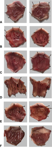 Figure 5 Representative images of stomachs from experimental groups. (A) Negative control group. (B) Ethanol‐treated group, (C) Lansoprazole‐treated group, (D) Azilsartan-treated group (1mg/kg), (E) Azilsartan-treated group (5mg/kg) and (F) Azilsartan-treated group (10mg/kg).