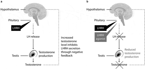 Figure 1. (A) Normal control of testosterone levels and (B) mechanism of action of LHRH agonists. LH: luteinizing hormone. LHRH: luteinizing hormone-releasing hormone.