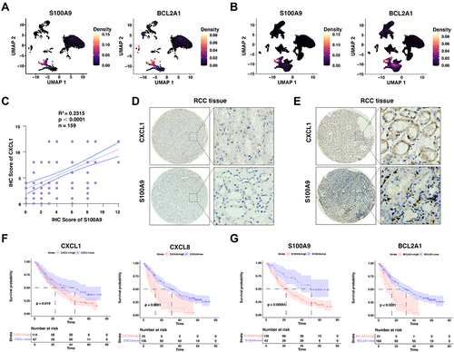 Figure 6 The validation of neutrophil marker genes in our ccRCC cohort, and its role in the prognosis of anti-PD1-based immunotherapy. (A and B) Density plot visualizing the expression of selected genes upregulated among different subpopulations in the normal kidney (A) and renal cell carcinoma tissues (B). Correlation between the immunohistochemistry scores between CXCL1 and S100A9 in renal cell carcinoma cohort. (C) Quantification of CXCL1 and S100A9 staining intensities were performed by semi-quantitative scoring. R2=0.2315, n = 159, r =, p < 0.0001; correlation coefficients were calculated using the Pearson test; two-sided p-value was given. (D) Representative images from IHC staining for low CXCL1 expression and low S100A9 expression in human renal cell carcinoma patients. (E) Representative images from IHC staining for high CXCL1 expression and high S100A9 expression in human renal cell carcinoma patients. (F and G) Kaplan-Meier plots showing the integrated survival time of three independent CheckMate trials with anti-PD-1 therapy based on CXCL1 (F) or S100A9 (G) expression levels. Two-sided Log rank test.