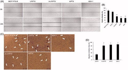 Figure 5. Migration inhibition effect of ADH-1-modified liposomes (A-LP/PTX) on MCF7 PTX-R cells. (A) Wound scratch assays were performed with a uniform scratch using a 200-μL pipette tip. Then, the cells were washed with culture media to remove any free-floating cells and debris and incubated in culture medium containing LP/PTX, A-LP/PTX, free ADH-1 (2 μM) before treated with PTX (A/PTX) or free ADH-1 (2 μM) alone for 24 h and observed at ×5 magnification with inverted microscope. (B) Relative motility was calculated using 10 randomly chosen distances across the wound at 0 h and 24 h. **p < .01, versus LP/PTX. (C) Optical images of cells (white arrows) on the bottom surface of the Transwell inserts after treatment with LP/PTX, A-LP/PTX, free ADH-1 (2 μM) before treated with PTX (A/PTX) or free ADH-1 (2 μM) alone for 24 h. (D) The inhibition rate was calculated by counting cells that migrated through polycarbonate membranes of the inserts. *p < .05, versus LP/PTX.