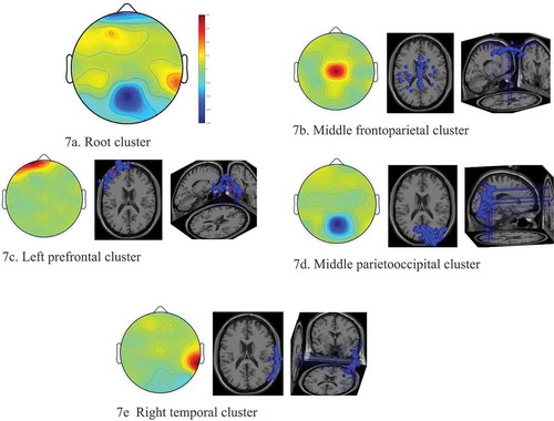Figure 7. Scalp maps and 3D dipole plots for the classical music stimulation results.(a) Root cluster, (b) Middle frontoparietal cluster, (c) Left prefrontal cluster, (d) Middle parietooccipital cluster, (e) Right temporal cluster.