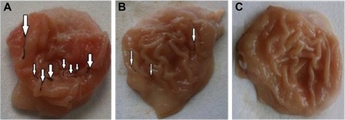 Figure 6 Morphology of gastric tissues of rats.Notes: After treatment with (A) piroxicam crystalline powder, (B) P188/0.2 formulation, and (C) 0.3% Tween 80 solution. Arrows indicate ulcers.Abbreviation: P188, poloxamer 188.