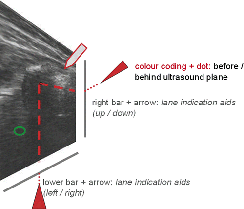 Figure 6. The position of the instrument tip (3D dataset) is integrated simultaneously into the 2D dataset of the ultrasound image. The instrument tip is visible in the ultrasound scan. The right bar and arrow indicate the trajectory of the instrument in the side view (up/down). The lower bar and arrow indicate the trajectory of the instrument in the top view (left/right).