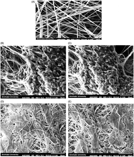 Figure 2. SEM imaging. Morphology of fabricated PES scaffold (A) Morphology of IPSC without differentiation (B and C) chondrogenic differentiated IPSC on nanofibrous PES (D and E).