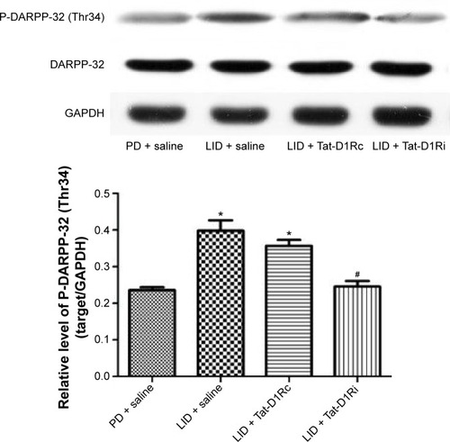 Figure 3 Effects of intrastriatal administration of Tat-D1Ri on DARPP-32 phosphorylation level after levodopa treatment in 6-OHDA-lesioned rats.