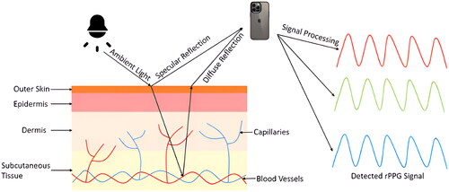 Figure 5. Principle of remote photoplethysmography (rPPG).The digital camera captures the specular and diffuse reflection from ambient light. The specular reflection contains surface information that does not relate to physiological signals, while the diffuse reflection is modulated by blood flow. The rPPG signal can be obtained from further signal processing.Modified from Cheng et al [Citation199].