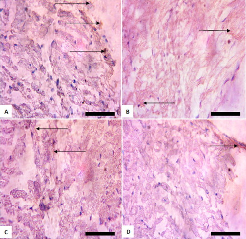 Figure 2. Immunohistochemistry of protein kinase B (PKB) in the kidneys of rats exposed to sodium arsenite for 4 weeks. (A) Control: shows positive expression of PKB; (B) 10 mg/kg NaAsO2 shows lower expression of PKB than control; (C) 20 mg/kg NaAsO2 shows no expression PKB; (D) 40 mg/kg NaAsO2: shows no expression PKB. The result is indicative that exposure of rats to NaAsO2 reduced the expressions of survival protein (Akt/PKB). Scale bar (for A, B, C, and D) = 5.04 × 3.87 mm. The slides were counterstained with high definition hematoxylin and viewed ×400 objectives.
