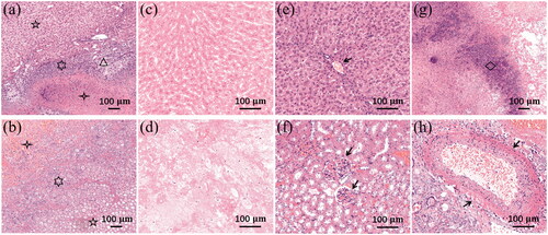 Figure 3. Histology of liver and kidney 72 h post-H-FIRE, H&E staining. (a) Liver ablation zone (five-pointed star), intact zone (four-pointed star), and transition zone (six-pointed star) with inflammation cells, bile duct proliferation, and fibrosis (triangle), 10x. (b) Kidney ablation zone (five-pointed star), intact zone (four-pointed star), and transition zone (six-pointed star) with inflammation cells, 10x. (c) Liver ablation zone with complete cellular necrosis, 20x. (d) Kidney ablation zone with complete cellular necrosis, 20x. (e) Liver intact zone with a capillary (arrow), 20x. (f) Kidney intact zone with visible glomeruli (arrows), 20x. (g) Inflammatory cells in the liver ablation zone (diamond), 10x. (h) A blood vessel in the kidney transition zone (arrows), 20x.