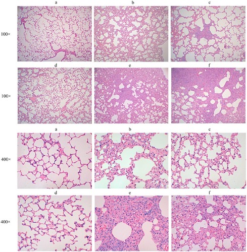 Figure 7 Histopathological assessment of lung tissues after C. psittaci infection.Notes: H&E-stained sections of lung tissue from each group of mice (magnification 100× and 400×) are shown as (A) SIM-CNPs-Ags group, (B) SIM-Ags group, (C) IN-CNPs-Ags group, (D) IM-CNPs-Ags group, (E) IN-CNPs-PBS group and (F) IM-CNPs-PBS group.Abbreviations: H&E, hematoxylin-eosin; SIM, simultaneous; IM, intramuscular; IN, intranasal; CNPs, chitosan nanoparticles; PBS, phosphate-buffered saline.