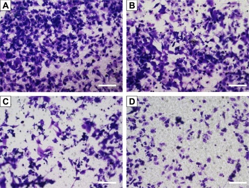 Figure 10 Transwell migration assay of HeLa cells after p53 transfection by different carriers: (A) control; (B) AP-PAMAM; (C) PAMAM/p53; and (D) AP-PAMAM/p53.Note: The scale bar is 100 μm.Abbreviations: AP-PAMAM, 2-amino-6-chloropurine-modified PAMAM; PAMAM, polyamidoamine.
