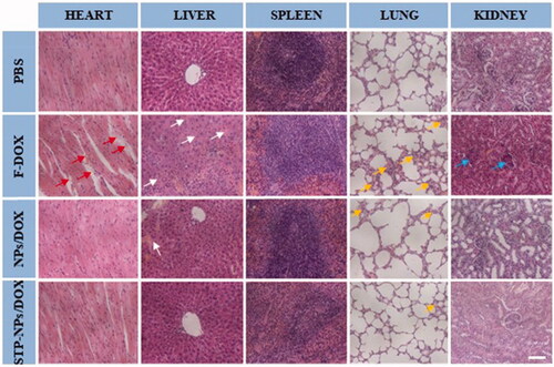 Figure 12. H&E staining of the heart, liver, spleen, lung, and kidney tissues from mice treated as indicated. Scale bar = 100 μm. Red arrows indicate the breakage of myocardial fibers. White arrows indicate the shrunken hepatocytes and inflammatory cell infiltration in liver tissues. Yellow arrows indicate the congestion, hyperplasia, and inflammatory cell infiltration in lung tissues. Blue arrows indicate the abnormal glomeruli in kidney tissues.