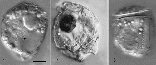 Figs 1 – 3. Cabra matta, gen. nov., sp. nov. Fig. 1. Low focus view of left lateral side. Arrow points to nucleus. Fig. 2. High focus view of right lateral side, showing dark (red) coloured inclusion, probably a food particle. Fig. 3. High focus view of left lateral side, showing suture between postcingular plates 2 and 3, and the areolate surface. All images taken using DIC optics. All images to same magnification, scale bar in Fig. 1 represents 10 μm.