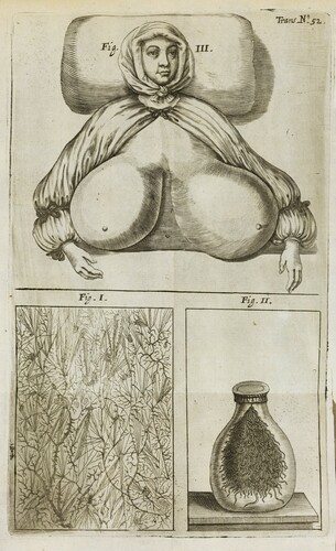 Figure 3. Fig. I. The dissected parts of human testicles, which comprise ‘nothing else but a congeries of Vessels of various sorts, and their several Liquors’, from Edmund King, Philosophical Transactions, 4, Issue 52 (1669). Courtesy of the Royal Society, London.