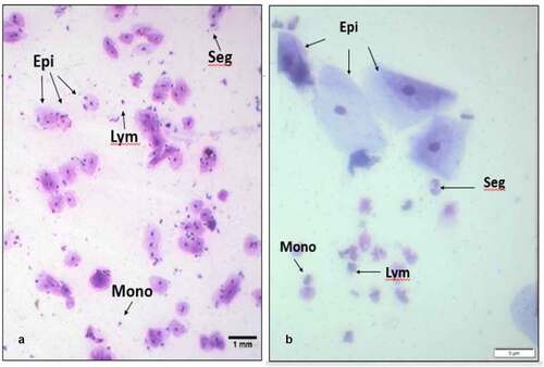 Figure 1. Examples of cellular morphology in oral samples. Representative fields of view from Diff-Quik staining of (a) saliva, 100x magnification and (b) OCA buccal sample, 400x magnification. Both samples contain large epithelial cells (Epi) with dense nuclei, and smaller immune cells, exemplified by lymphocytes (Lym), segmented cells (Seg) and monocytes (Mono).