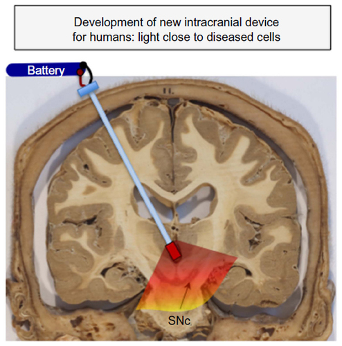Figure 3 Development of new intracranial device for humans.