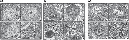 Figure 2. Transmission Electron micrographs of cerebral cortex. (a) TEM of control. A -C. Showed normal pyramidal cell with nuclei having peripheral heterochromatin, and euchromatin containing vesicular nucleoli and thin cytoplasm containing rich RER, and mitochondria. D. Showing non-myelinated axons. Abbreviations; M, mitochondria, NMA, non-myelinated axon; N, nucleus, NE, nuclear envelope; Nu, nucleolus; RER, rough endoplasmic reticulum. (b) TEM of cerebral neurons of diabetic rat. A - B. Showed Pyramidal cell with nuclei having densely compacted heterochromatin and cytoplasm with vesiculated rough endoplasmic reticulum and atrophied mitochondria. C. Showed congested blood capillaries. D. showed widespread of demyelinated axons. Abbreviations; DM; damaged mitochondria; DMA, demyelinated axons; KN, karyolitic nuclei; PN, pyknotic nuclei. (c) Transmission electron micrographs of cerebral cortex of diabetic rat received dietary peanut. A-C. Showed an improvement at pyramidal cells with peripheral heterochromatin and cytoplasm containing rich RER, and mitochondria. Arrow head in figure A. showed satellite cells present adjacent to some neurons. D. Showed the myelinated axons.