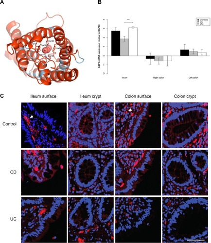 Figure 1 AQP1 expression is reduced in the ileum of CD patients.