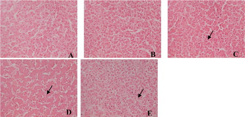 Figure 1. Hepatic histology in laying hens fed a control diet supplemented with 0 (A), 20 (B),70 (C), 120 (D) and 170 mg/kg FG(E) (haematoxylin-eosin staining, original magnification×40). Hepatic histology shows acidophil body (arrows) in mild hepatitis in FG 70 (C), FG 120 (D) and FG 170 (E) groups.